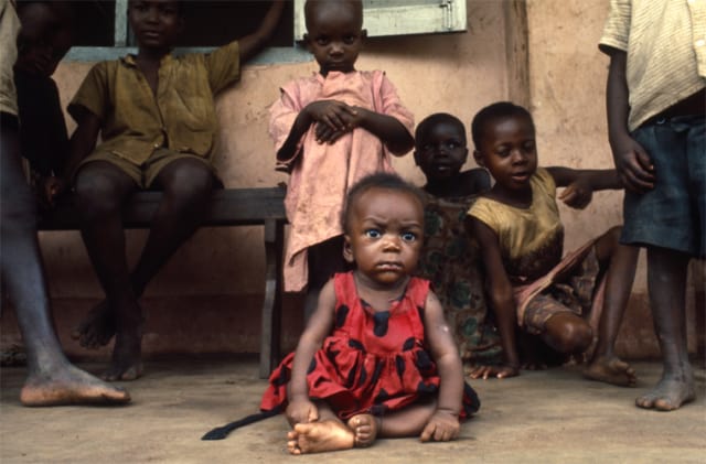 La famine,Sécession de la province du Biafra, Nigéria, juillet 1968, GC-B-080 ©Fondation Gilles Caron